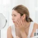Skin Barrier Rusak: Kenali Tanda, Penyebab, dan Cara Mengatasinya agar Kulit Kembali Sehat